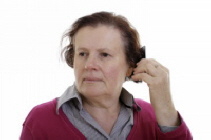 Haartransplantation Preise Frauen Haartransplantation Preise Frauen